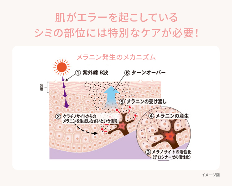 肌がエラーを起こしているシミの部位には特別なケアが必要!